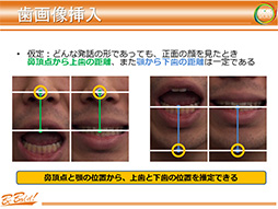 画像ギャラリー No.020のサムネイル画像 / ［CEDEC 2013］早稲田大学が発表した次世代のグラフィックス表現は「埃」と「口内」に注目？